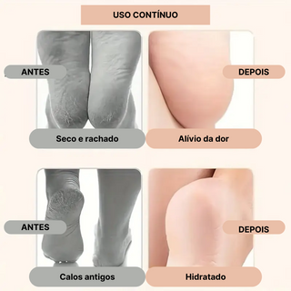 MEIAS DE SILICONE HIDRATANTES PARA PÉS - PÉS SEDOSOS E HIDRATADOS